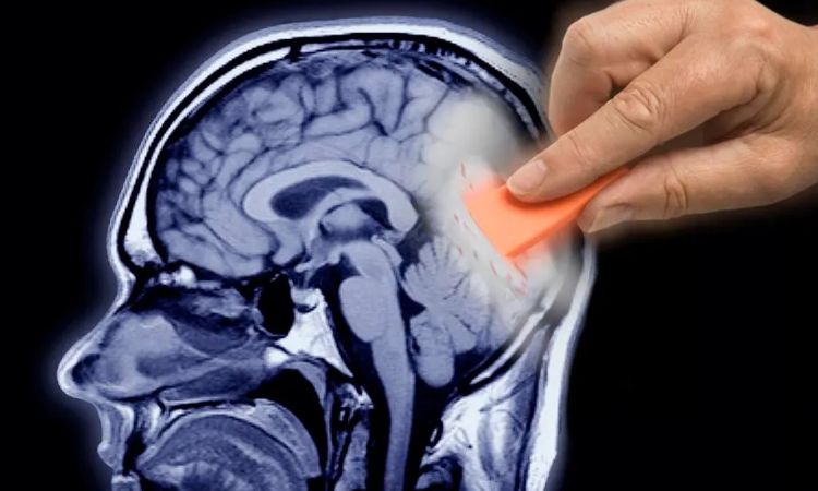 Pros and Cons of Erasing Memories